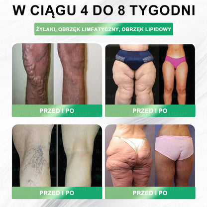 🍃Oficjalny sklep Polska | 🍃BuildLeaf® GLP-1 8-w-1 Fit & Vital Rozwiązanie (Jednorazowe dziennie, widoczne zmiany w ciągu 7 dni) ✅ Otyłość, zdrowie sercowo-naczyniowe, cukrzyca, bezdech senny, zdrowie jelit, problemy ze stawami i inne.